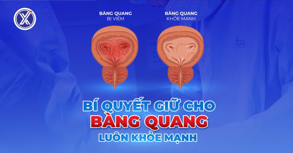 Bí quyết giữ cho bàng quang luôn khoẻ mạnh
