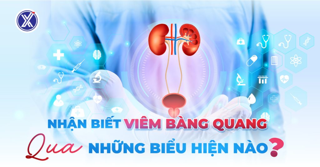 Nhận biết viêm bàng quang qua những dấu hiệu nào